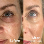 Sculptora Contour™ Pro